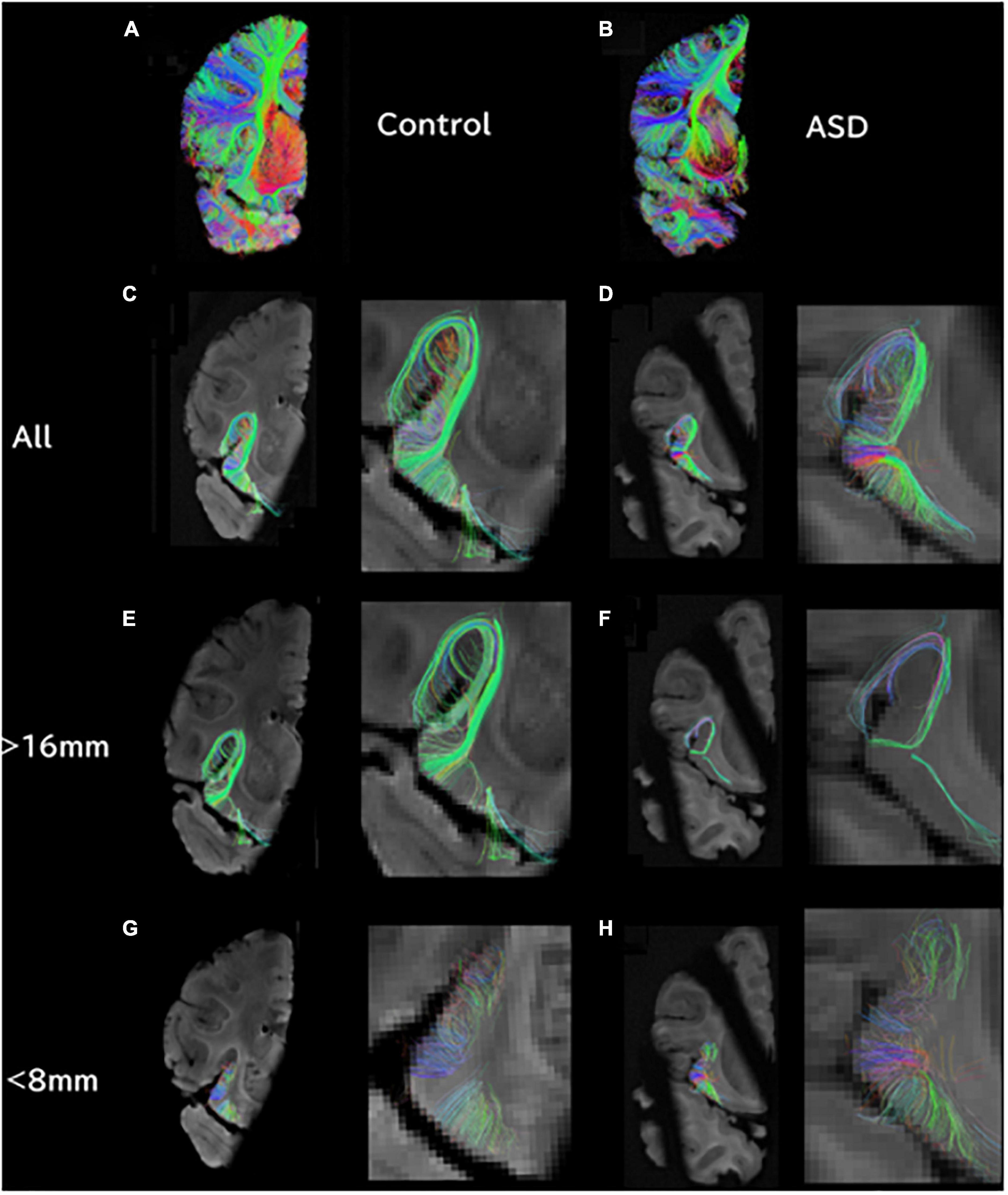 Frontiers Integration of structural MRI and epigenetic analyses